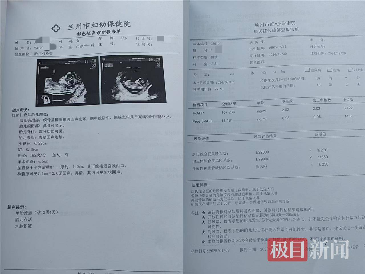 二胎出生查出先天性病症或落下残疾<strong></p>
<p>百链币</strong>，残疾父母称医院产检漏检、未尽告知义务，医院及医调委回应