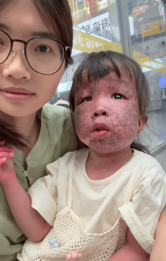 上饶6岁女童患病满身红斑<strong></p>
<p>xrp</strong>，初上幼儿园妈妈字里行间满是担心：曾经绝望，现在能看到光
