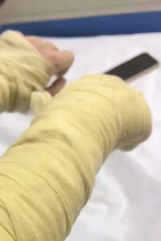 湖南一女主播被伪装的包裹炸伤<strong></p>
<p>FIL</strong>，永州公安：正在核实具体情况