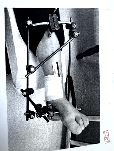 男子停车场随地小便被制止<strong></p>
<p>btc实时价格</strong>，恼羞成怒飞踹管理员致自己骨折，索赔18万余元，法院判了